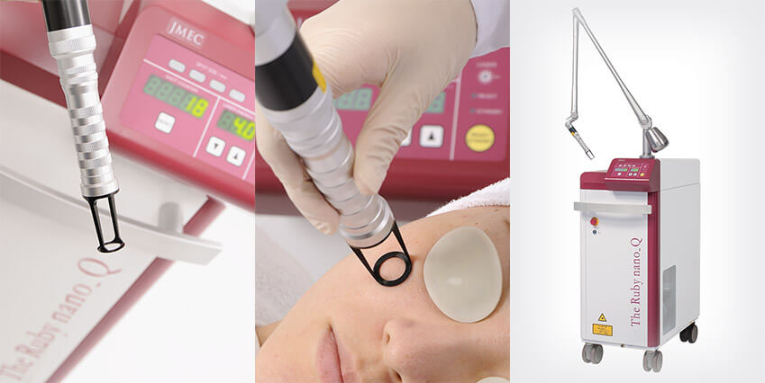 The Ruby(Qスイッチルビーレーザー)