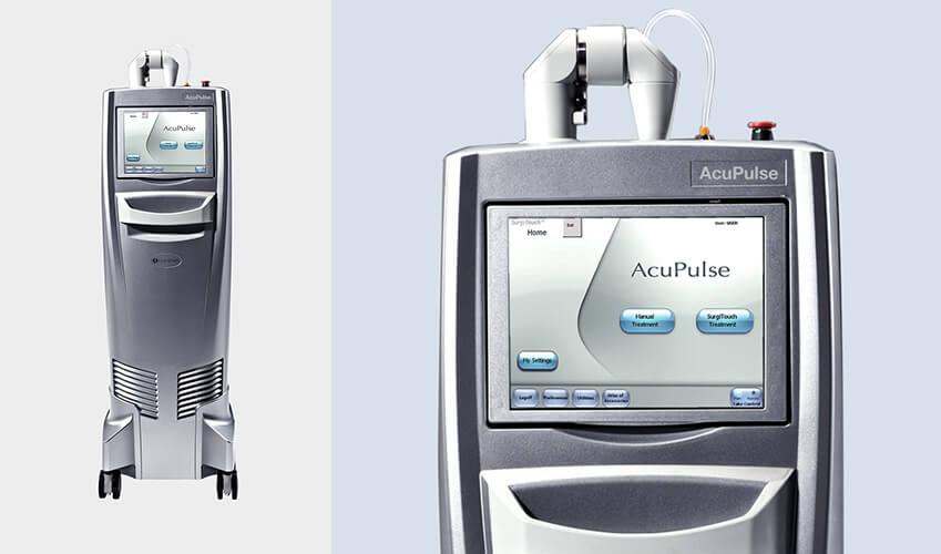 アキュパルス(高性能炭酸ガスレーザー)