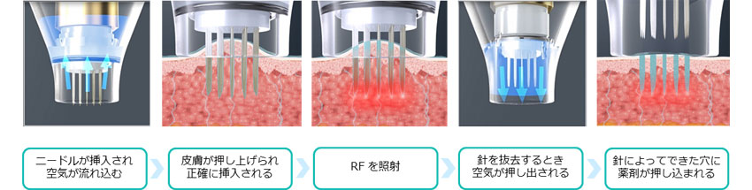 POTENZA(ポテンツァ)